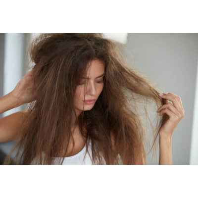 FRIZZ CONTROL